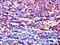 LCK Proto-Oncogene, Src Family Tyrosine Kinase antibody, A56046-100, Epigentek, Immunohistochemistry paraffin image 
