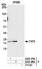 YKT6 V-SNARE Homolog antibody, A305-479A, Bethyl Labs, Immunoprecipitation image 