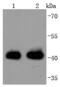 Major Histocompatibility Complex, Class I, A antibody, A00194, Boster Biological Technology, Western Blot image 