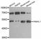 PNMA Family Member 8A antibody, LS-C747282, Lifespan Biosciences, Western Blot image 