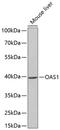 2'-5'-Oligoadenylate Synthetase 1 antibody, A01684, Boster Biological Technology, Western Blot image 