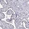 Kinesin Family Member 19 antibody, HPA073303, Atlas Antibodies, Immunohistochemistry paraffin image 