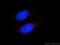 Centromere Protein J antibody, 11517-1-AP, Proteintech Group, Immunofluorescence image 