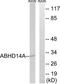 Abhydrolase Domain Containing 14A antibody, TA315291, Origene, Western Blot image 
