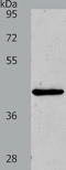 Matrix Metallopeptidase 13 antibody, TA321485, Origene, Western Blot image 