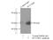 Histone-lysine N-methyltransferase SUV39H1 antibody, 10574-1-AP, Proteintech Group, Immunoprecipitation image 