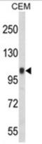 Integrin beta-3 antibody, AP18079PU-N, Origene, Western Blot image 