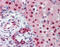 Small RNA Binding Exonuclease Protection Factor La antibody, 29-309, ProSci, Immunohistochemistry paraffin image 