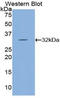 Serine/threonine-protein kinase LMTK1 antibody, LS-C292918, Lifespan Biosciences, Western Blot image 