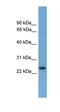 DExH-Box Helicase 58 antibody, orb329872, Biorbyt, Western Blot image 