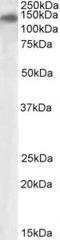 Phospholipase A2 Receptor 1 antibody, TA311382, Origene, Western Blot image 