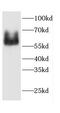Calcium/Calmodulin Dependent Protein Kinase II Gamma antibody, FNab01234, FineTest, Western Blot image 