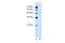 Solute Carrier Family 2 Member 6 antibody, A11862, Boster Biological Technology, Western Blot image 
