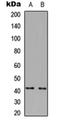 Zinc Finger DHHC-Type Containing 18 antibody, orb234980, Biorbyt, Western Blot image 
