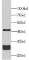 Sirtuin 3 antibody, FNab07881, FineTest, Western Blot image 