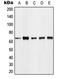 Forkhead Box O4 antibody, LS-C352512, Lifespan Biosciences, Western Blot image 
