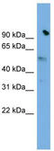 Solute Carrier Family 25 Member 25 antibody, TA333570, Origene, Western Blot image 