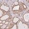 Round Spermatid Basic Protein 1 antibody, HPA049484, Atlas Antibodies, Immunohistochemistry paraffin image 