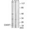 Cancer-related nucleoside-triphosphatase antibody, A13743, Boster Biological Technology, Western Blot image 
