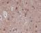 P21 (RAC1) Activated Kinase 3 antibody, P03124, Boster Biological Technology, Immunohistochemistry frozen image 