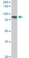 HIC ZBTB Transcriptional Repressor 1 antibody, LS-C197409, Lifespan Biosciences, Western Blot image 
