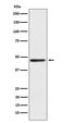 Ectonucleoside Triphosphate Diphosphohydrolase 5 (Inactive) antibody, M06908-2, Boster Biological Technology, Western Blot image 