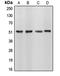 CUGBP Elav-Like Family Member 1 antibody, MBS820501, MyBioSource, Western Blot image 