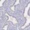 Keratin 17 antibody, HPA000453, Atlas Antibodies, Immunohistochemistry paraffin image 