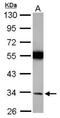 Torsin Family 1 Member A antibody, NBP2-20685, Novus Biologicals, Western Blot image 