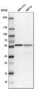 Phosphoglycerate Dehydrogenase antibody, HPA021241, Atlas Antibodies, Western Blot image 
