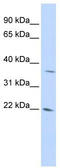 DNA Damage Inducible Transcript 4 Like antibody, TA340396, Origene, Western Blot image 