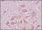 Integrin Subunit Beta 1 antibody, 251162, Abbiotec, Immunohistochemistry paraffin image 
