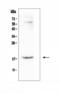 LCC-1 antibody, A07545-1, Boster Biological Technology, Western Blot image 