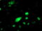 PHD Finger Protein 21B antibody, TA503245, Origene, Immunofluorescence image 