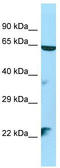 Serine/Threonine Kinase 35 antibody, TA334387, Origene, Western Blot image 