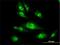 Proteasome 26S Subunit, ATPase 4 antibody, H00005704-M01, Novus Biologicals, Immunofluorescence image 
