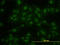 Kruppel Like Factor 11 antibody, LS-C133547, Lifespan Biosciences, Immunofluorescence image 