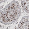 Heterogeneous Nuclear Ribonucleoprotein C (C1/C2) antibody, AMAb91010, Atlas Antibodies, Immunohistochemistry paraffin image 