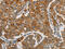 Forkhead Box F2 antibody, CSB-PA027320, Cusabio, Immunohistochemistry frozen image 