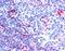 Neuroepithelial Cell Transforming 1 antibody, MBS421447, MyBioSource, Immunohistochemistry frozen image 