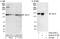 Phosphoinositide-3-Kinase Regulatory Subunit 4 antibody, A302-571A, Bethyl Labs, Western Blot image 