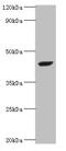 StAR-related lipid transfer protein 7, mitochondrial antibody, A53674-100, Epigentek, Western Blot image 
