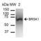 BR Serine/Threonine Kinase 1 antibody, LS-C776988, Lifespan Biosciences, Western Blot image 