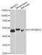CHRNA7 (Exons 5-10) And FAM7A (Exons A-E) Fusion antibody, A12603, ABclonal Technology, Western Blot image 