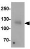 LEM Domain Containing 3 antibody, GTX17158, GeneTex, Western Blot image 