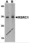 Arginine And Serine Rich Coiled-Coil 1 antibody, 5607, ProSci, Western Blot image 