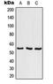 Serine And Arginine Rich Splicing Factor 11 antibody, orb214886, Biorbyt, Western Blot image 