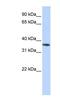 Olfactory Receptor Family 13 Subfamily C Member 5 antibody, NBP1-79975, Novus Biologicals, Western Blot image 