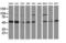 Protein kinase C and casein kinase substrate in neurons protein 3 antibody, LS-C172565, Lifespan Biosciences, Western Blot image 