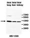 Serpin Family B Member 6 antibody, orb77857, Biorbyt, Western Blot image 